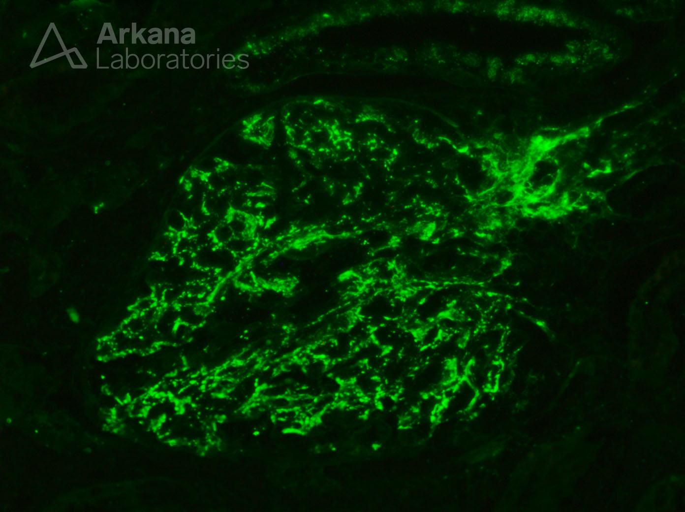 Granular, Glomerular C3 Deposition